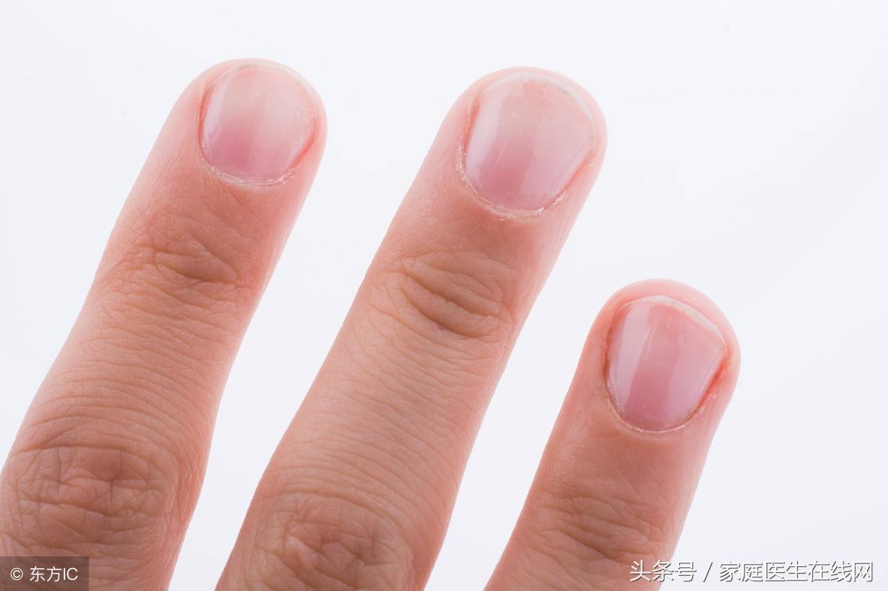 健康的手指甲,健康的指甲是什么样的？