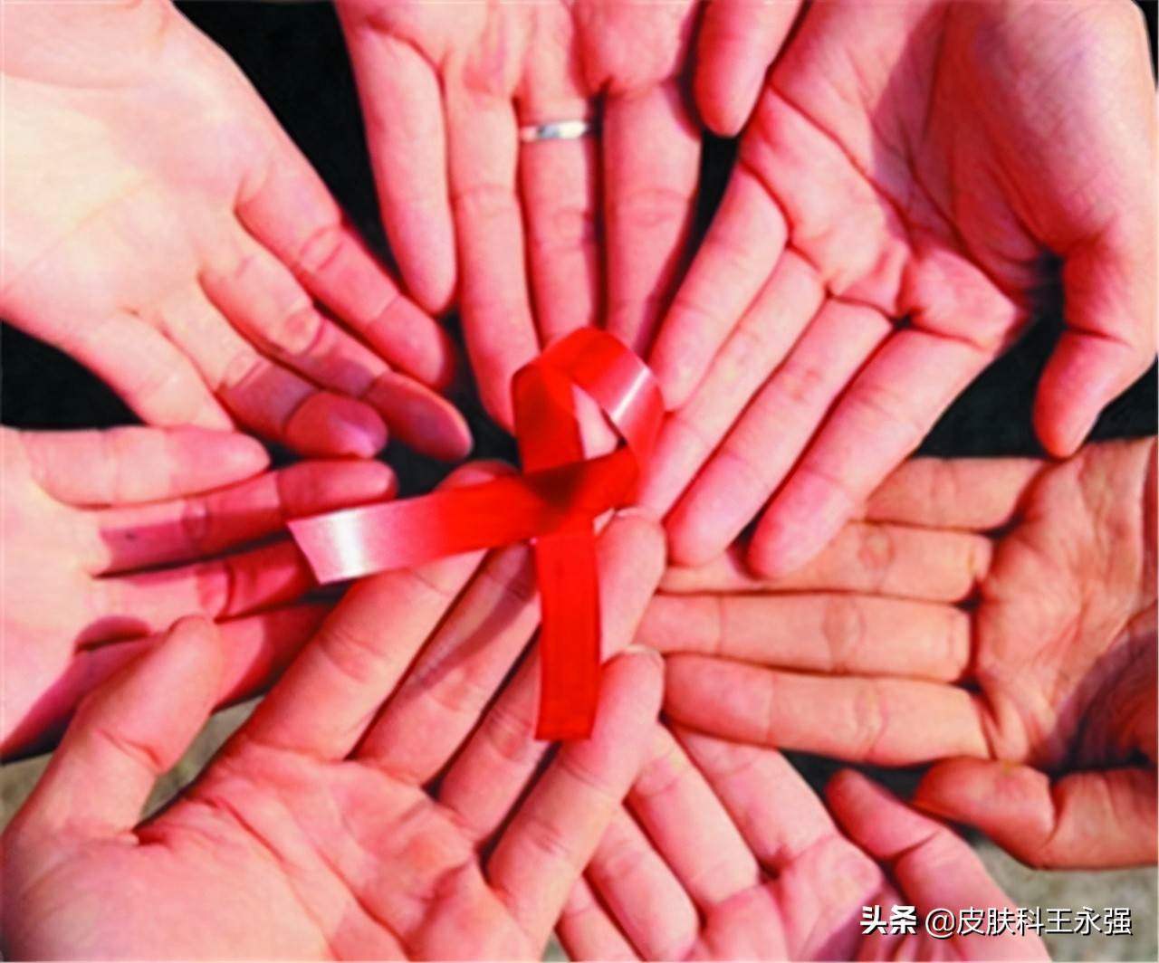 艾滋病患者早期症状,艾滋病患者，前期会有哪些表现？