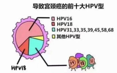 HPV感染一定要谨记哪几点，如何才能更好转阴