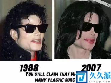 杰克逊鼻子哪年掉了(迈克尔杰克逊的皮肤怎么变白的)