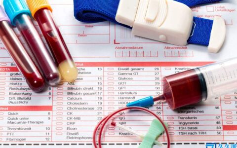 体检验血项目清单(血检有哪些)
